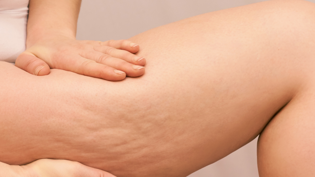 What Exactly Is Body Image Dysmorphia? (And What Can You Do About It ...